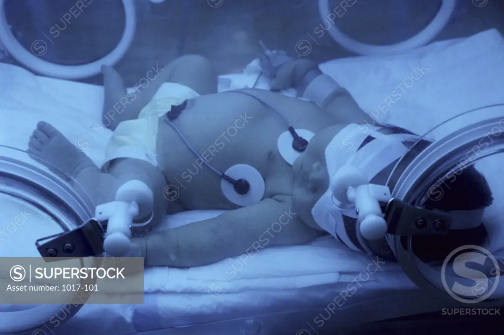 Premature Baby in Incubator