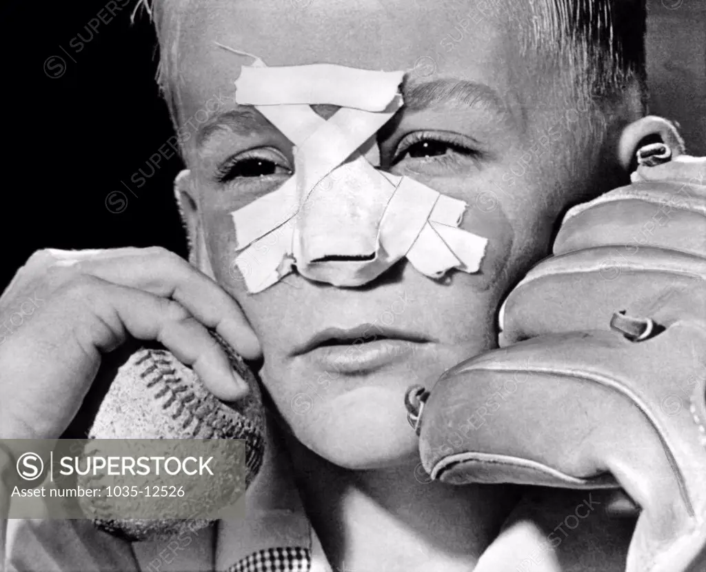 Topeka, Kansas:  June 7, 1962 A nine year old boy with a broken nose from when he misjudged a fly ball in practice with his father.