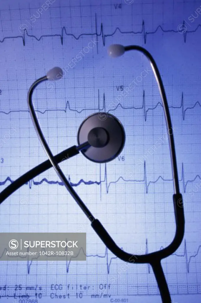 Close-up of a stethoscope on an ECG