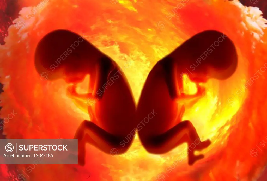 Close-up of twin fetus in womb