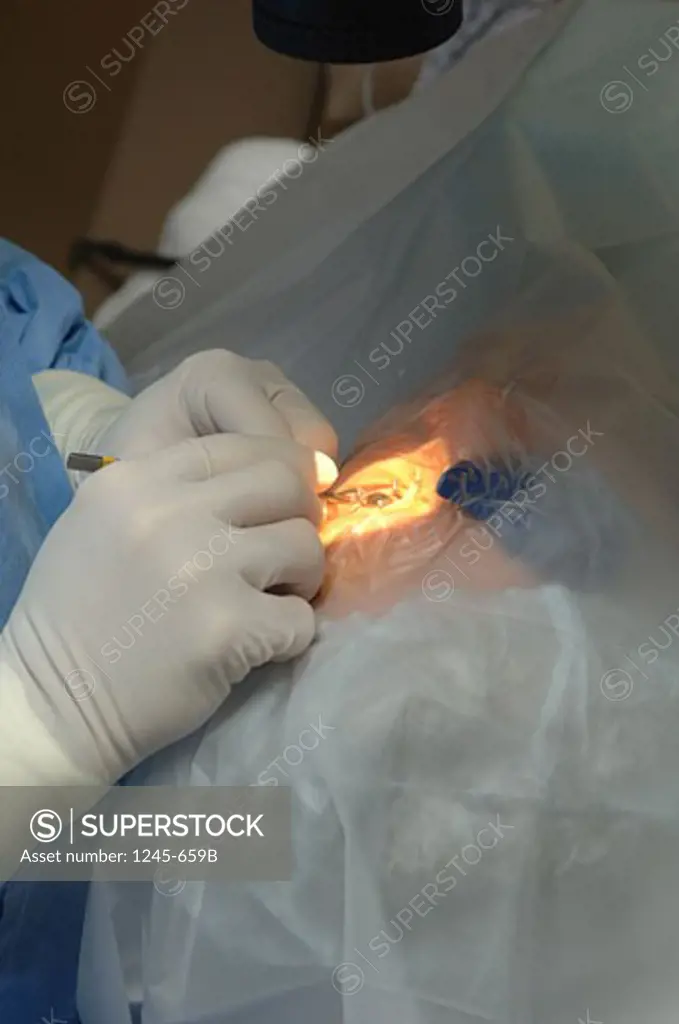 Surgeon operating on a patient's eye