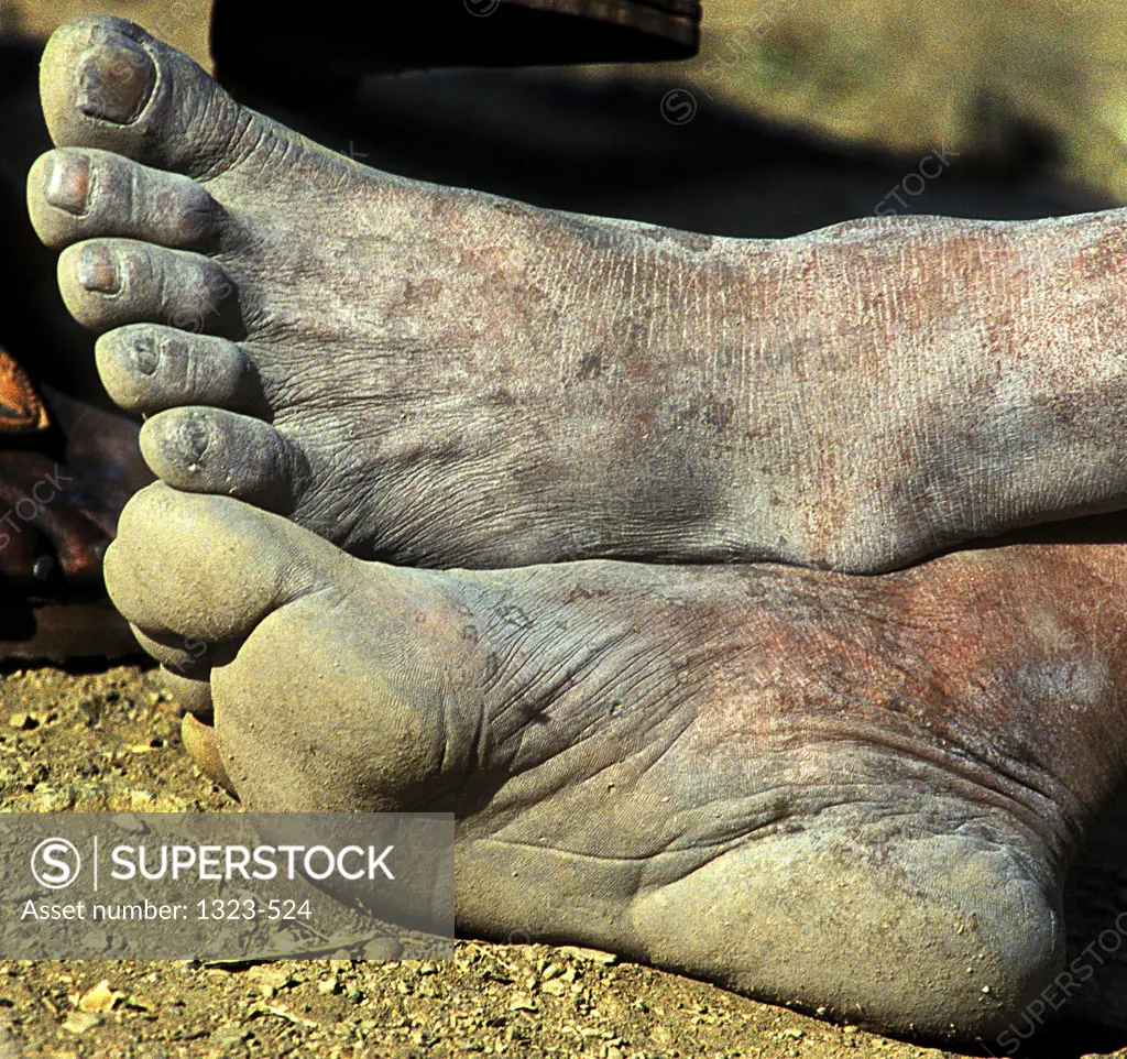 Close-up of a person's dirty feet