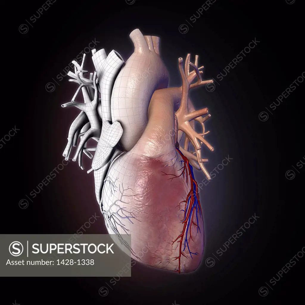 Human heart with wire frame, appearing like frozen mechanical heart on black background