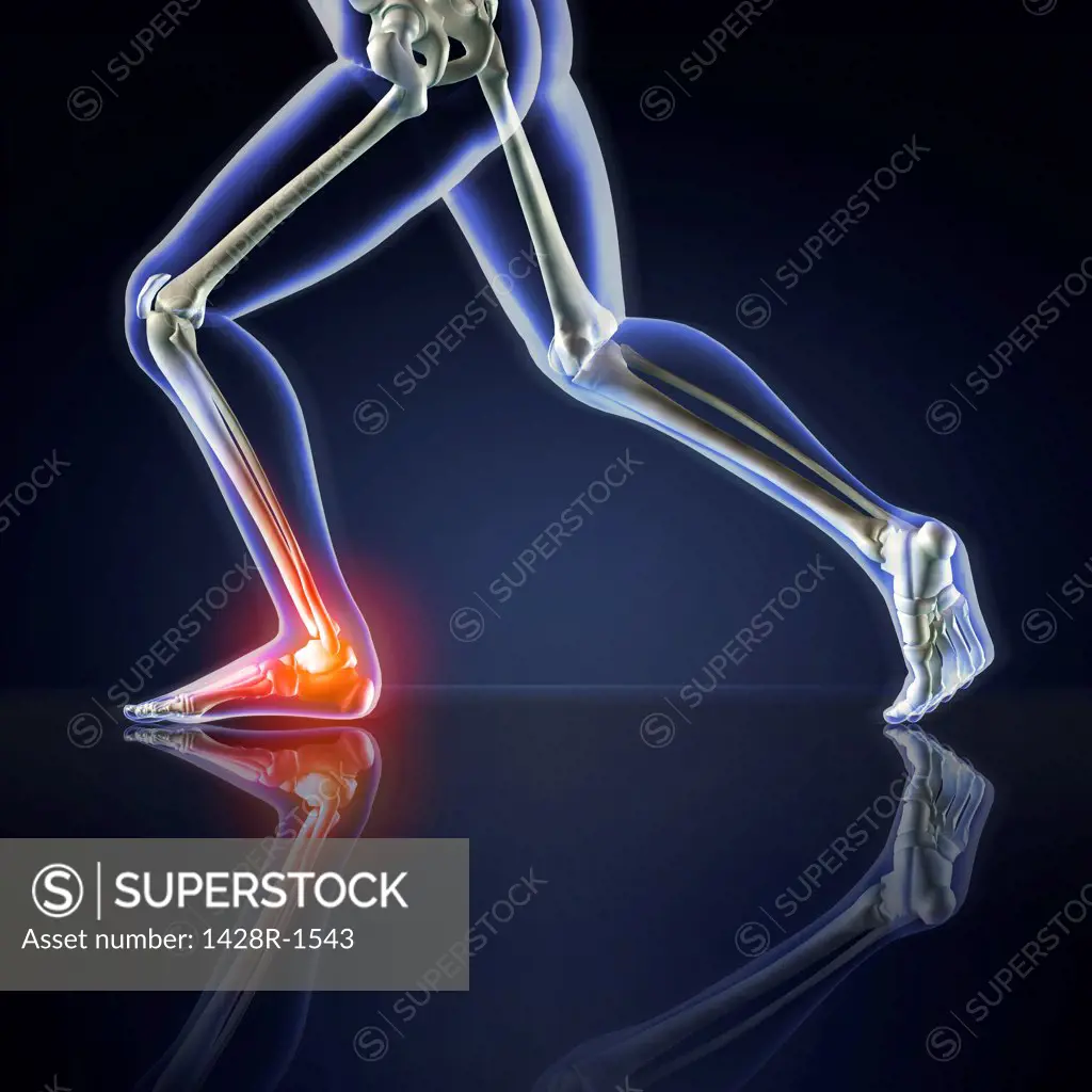 Man's legs running with ankle pain, blue X-ray on a dark blue reflective background