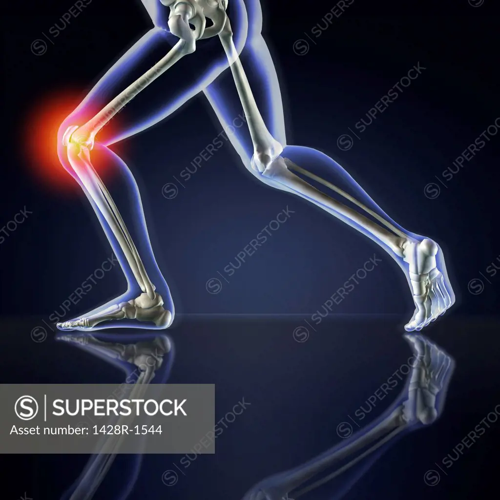 Man's legs running with knee pain blue X-ray on a dark blue reflective background