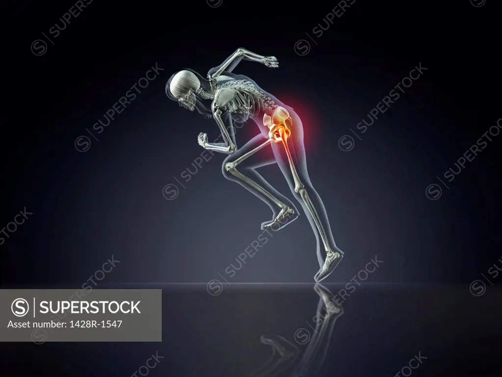X-ray of woman's skeleton running with hip pain on dark blue background