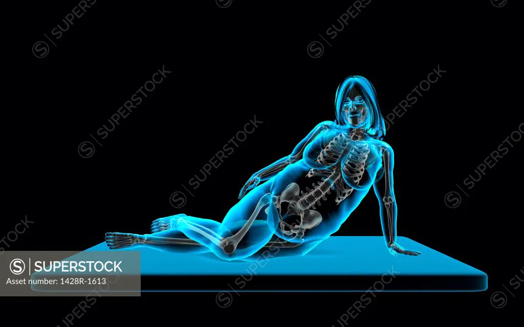 Rubenesque nude woman reclining on side, X-ray image