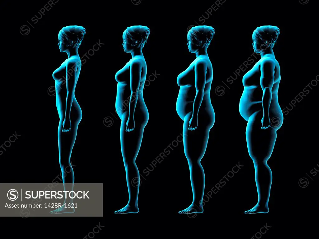 Four women gaining weight, X-ray image