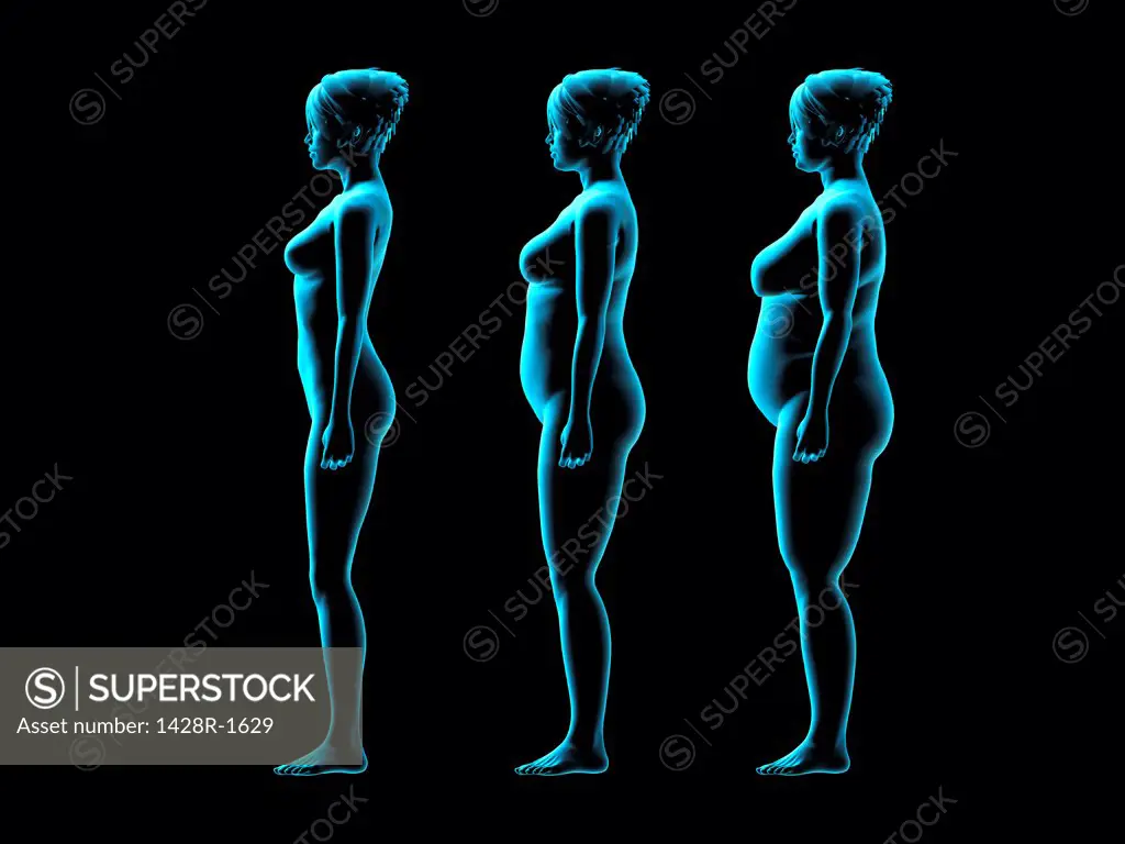 Three women gaining weight, X-ray image