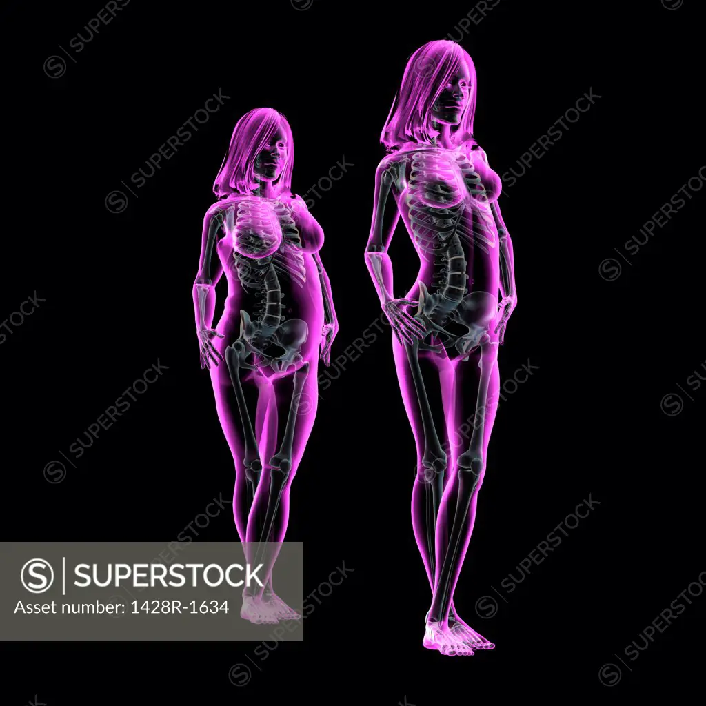 Obese and thin women posing in catwalk style, X-ray image