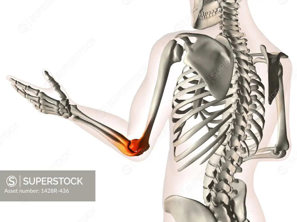 X-ray view of elbow joint red with inflammation in a see-through arm with hand and spinal bones
