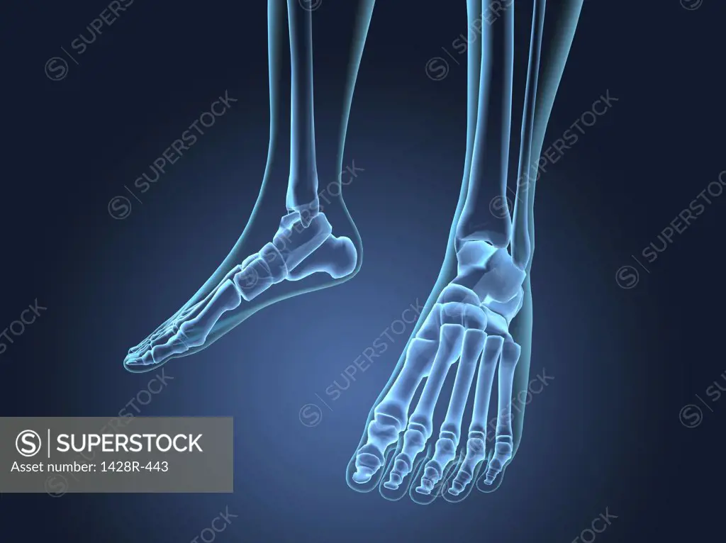 X-ray view of foot bones