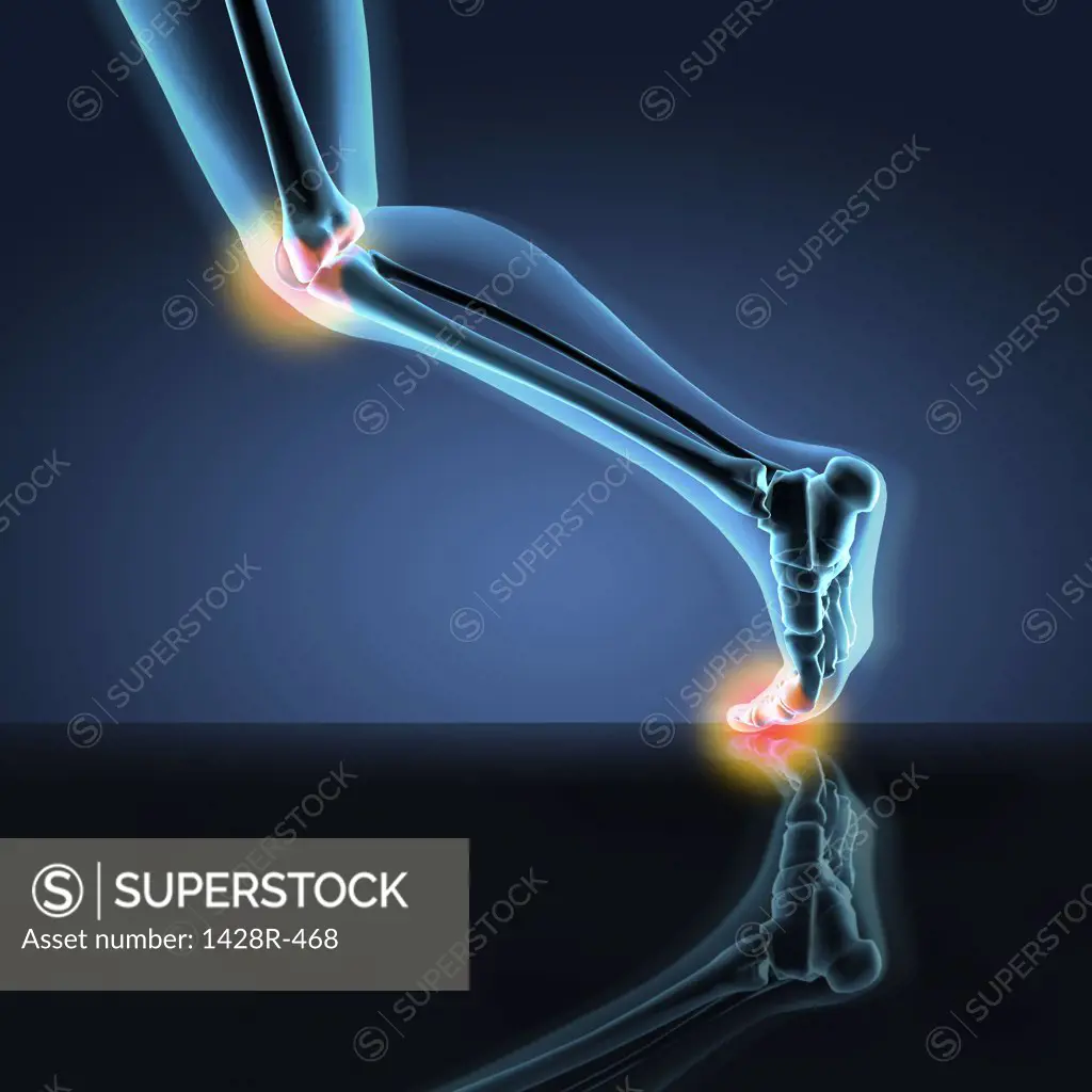 X-ray view of a human's leg showing pain in knee, ankle and foot in running position