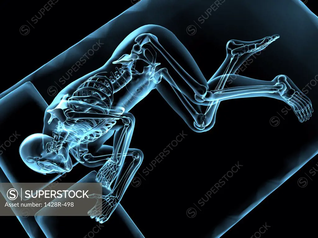 X-ray view of man sleeping