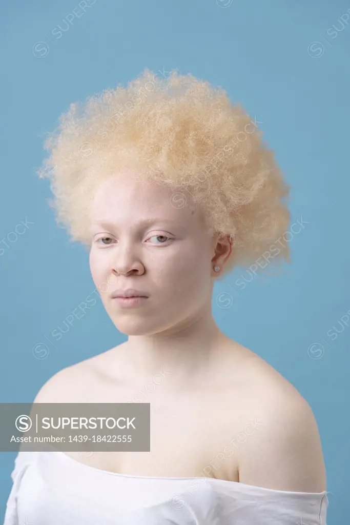 Studio portrait of albino woman