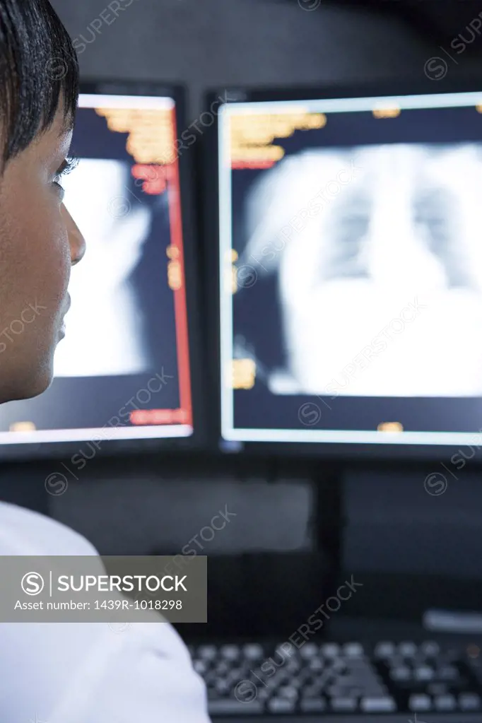 Doctor looking at chest scans