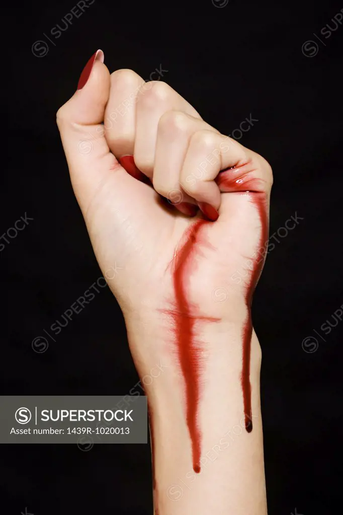 Woman with blood on her hand and wrist