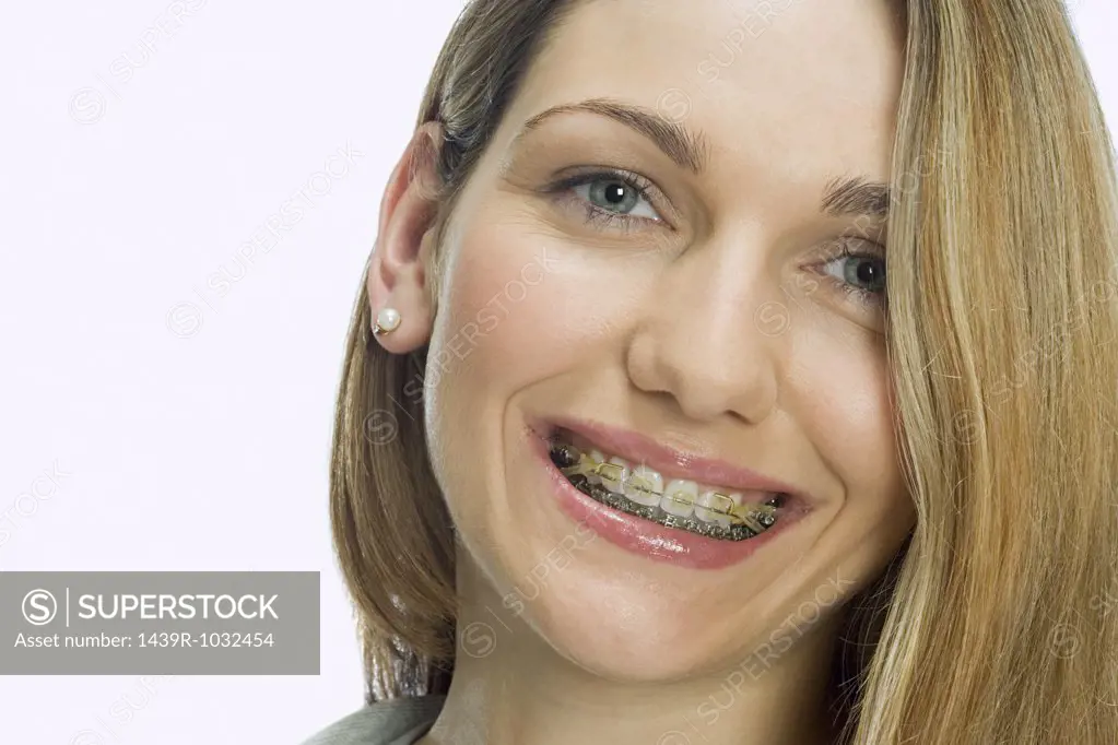 Woman wearing braces