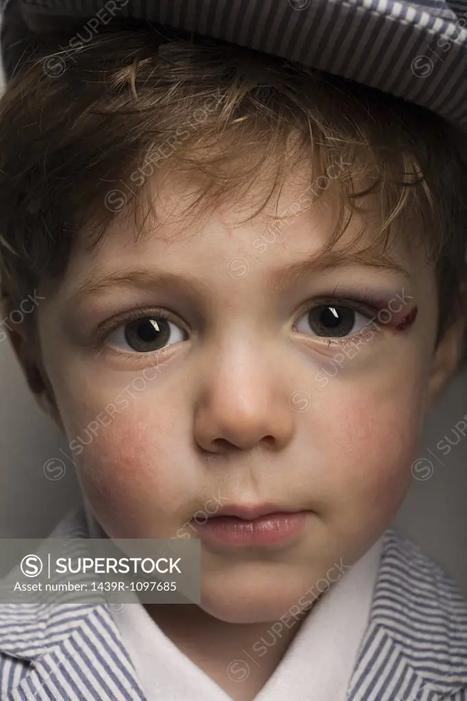 Boy with an injury