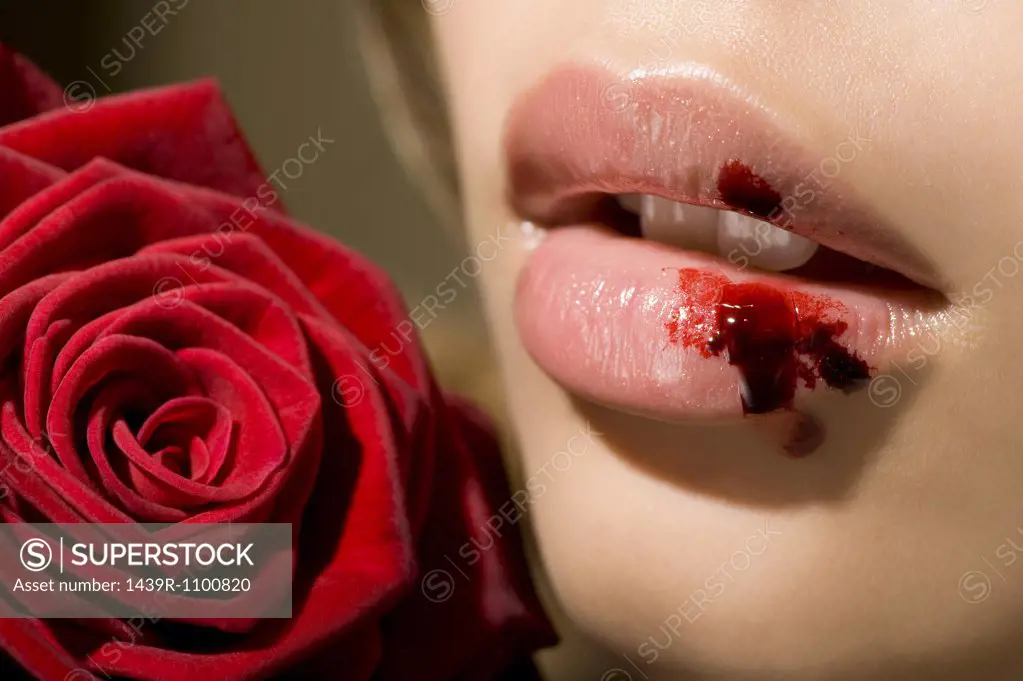 A woman with a bleeding lip