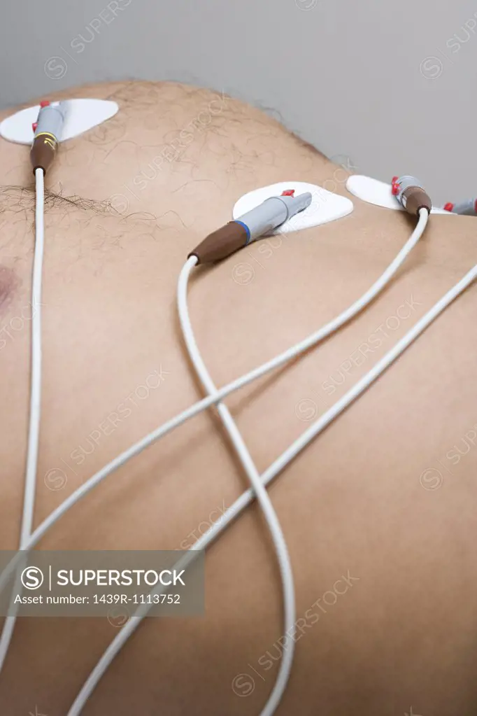 Person with electrodes on chest