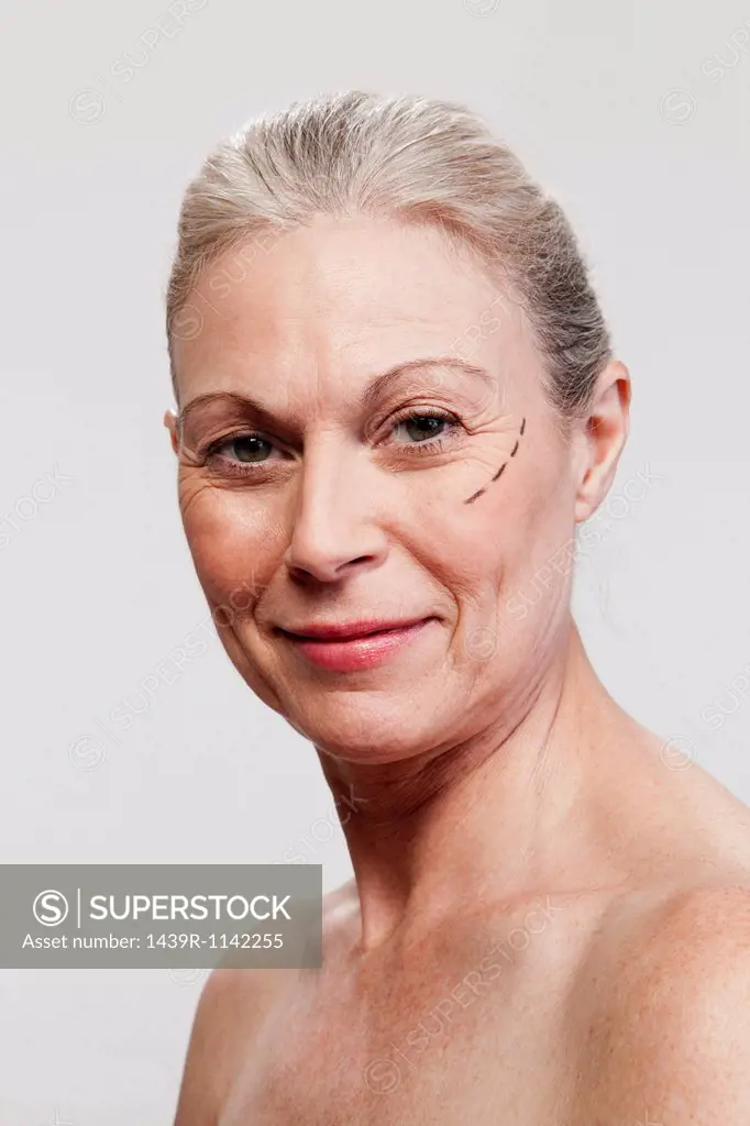 Mature woman with cosmetic surgery marking