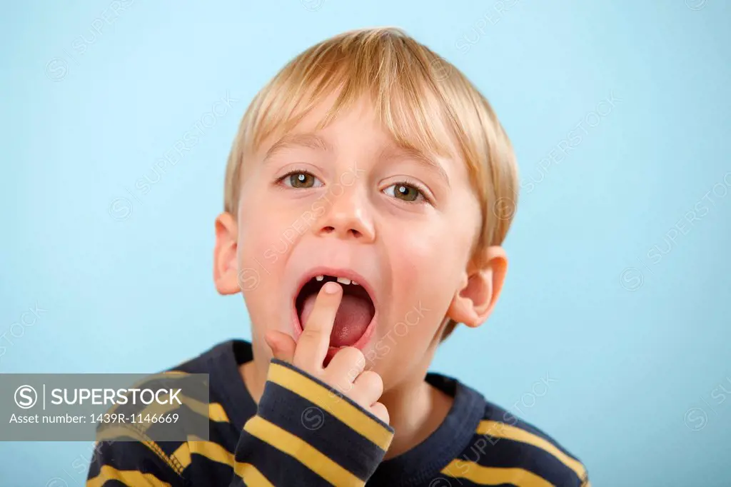 Boy pointing to gap in teeth