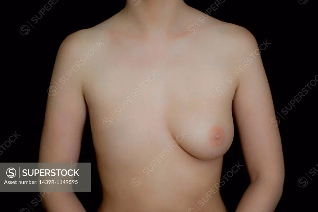 Naked female body with one breast against black background