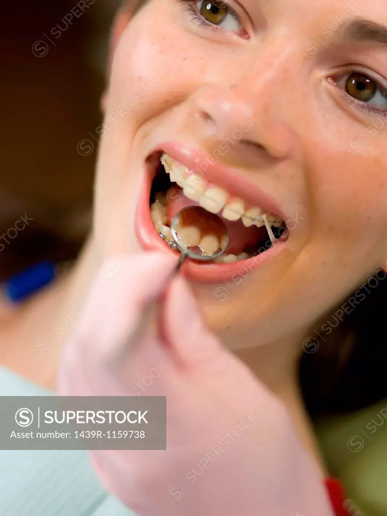 Dentist examining young woman´s teeth, close up