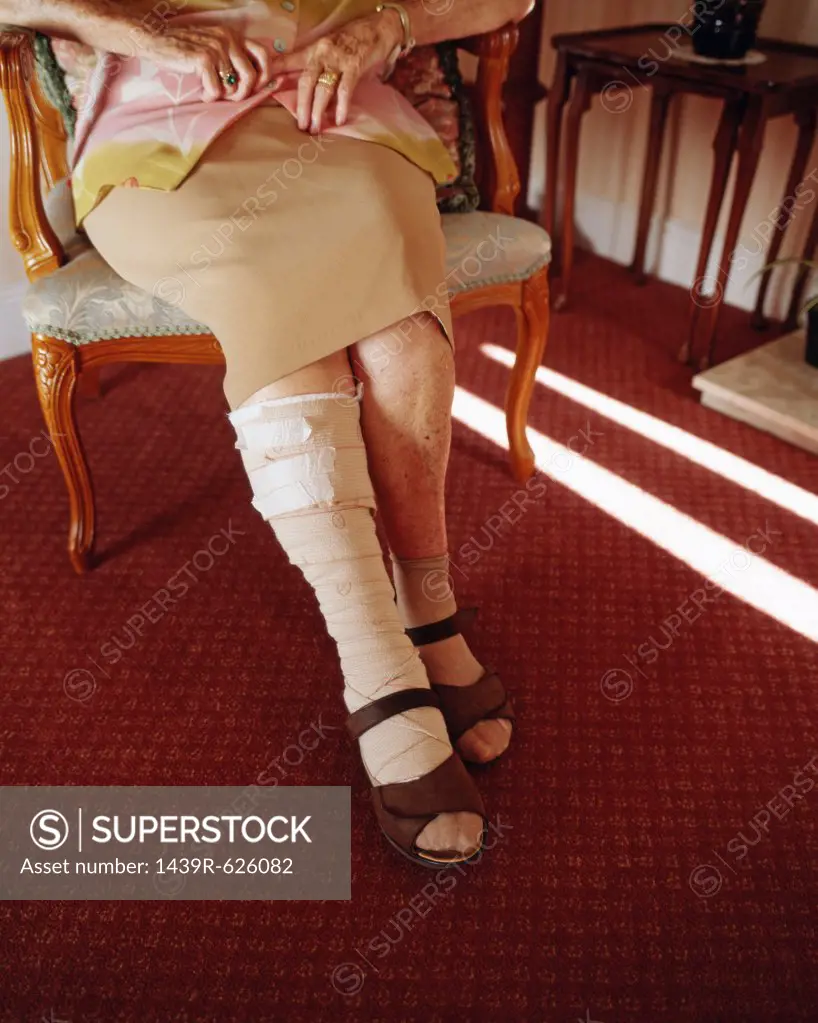 Elderly woman with bandaged leg