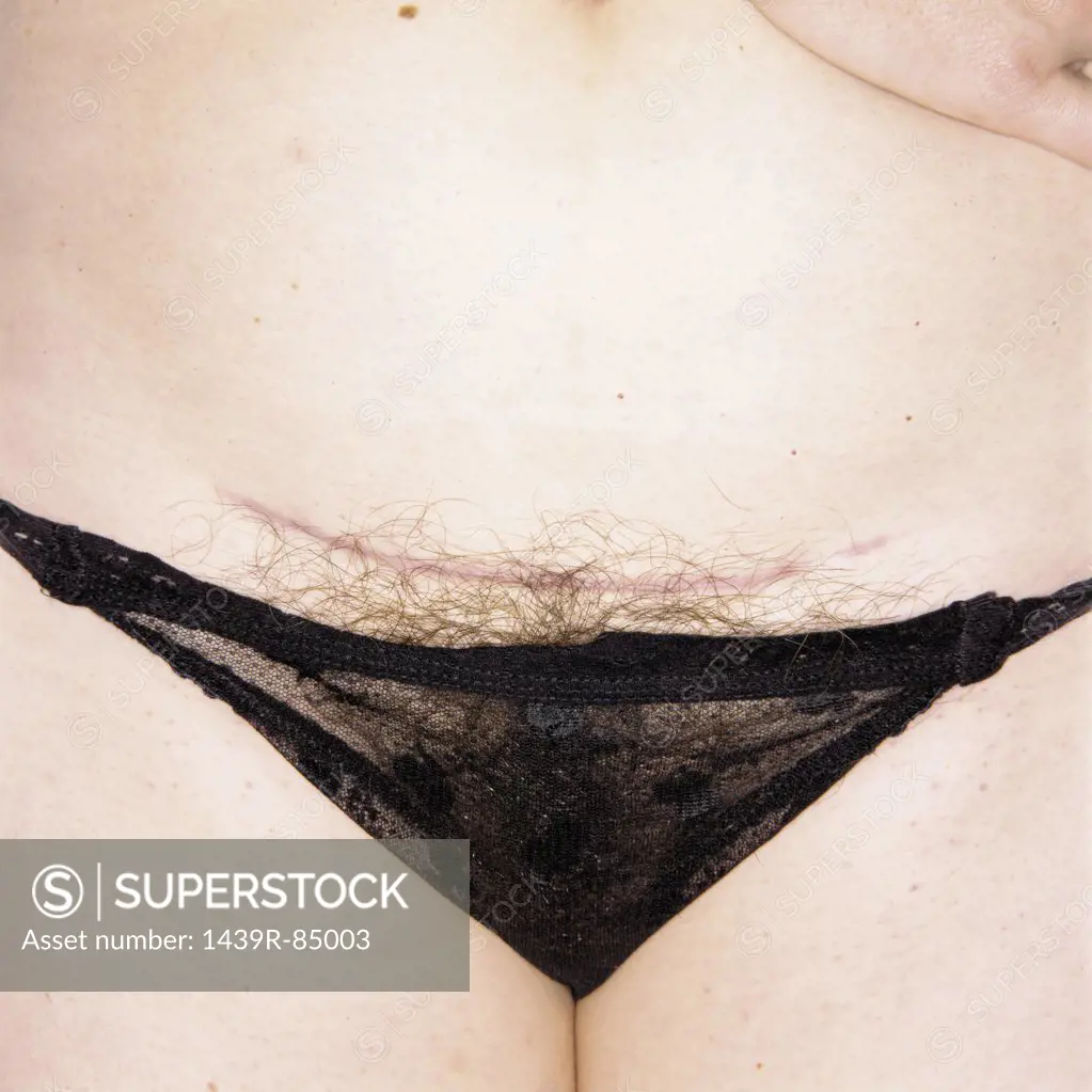 Female crotch - SuperStock