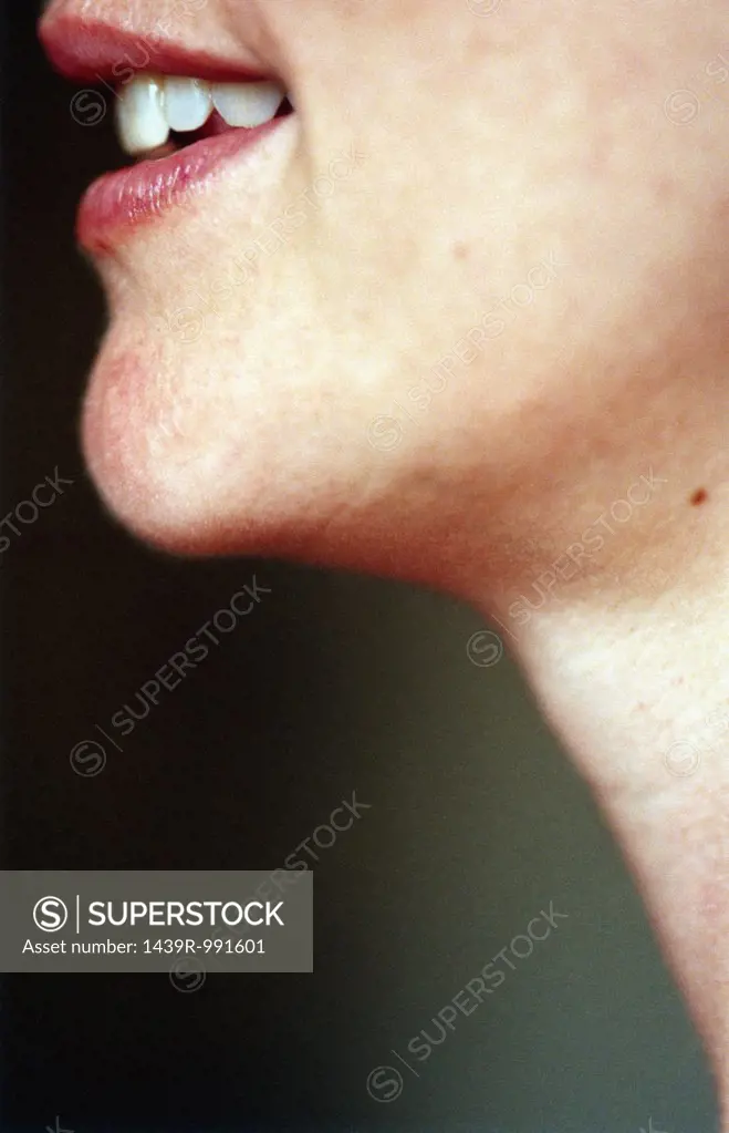 Profiled female chin 