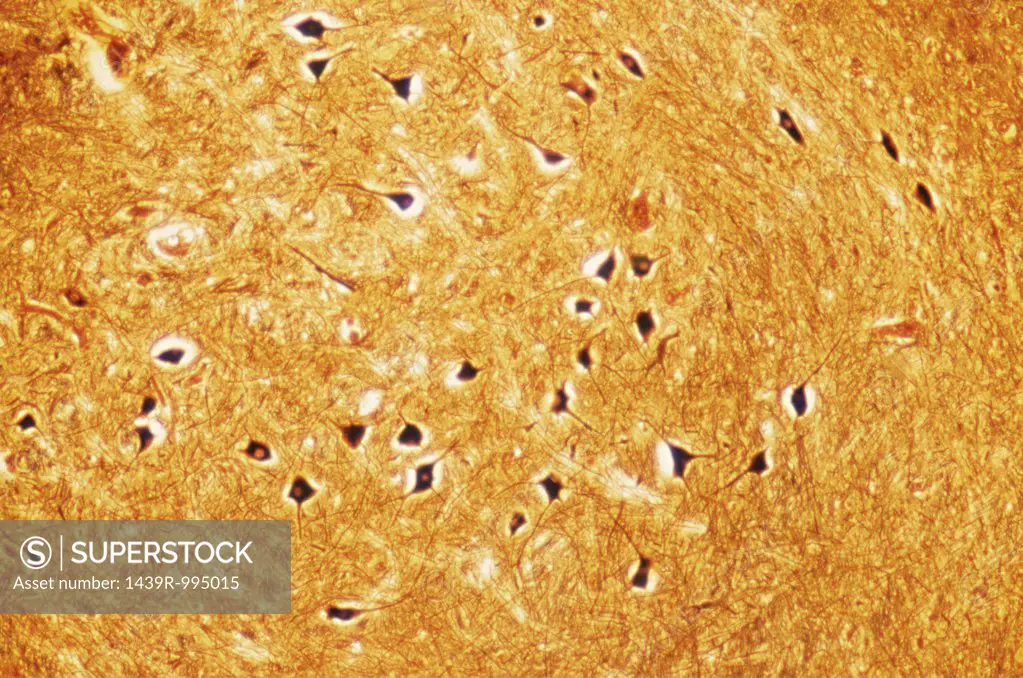 Nerve cells from brain stem