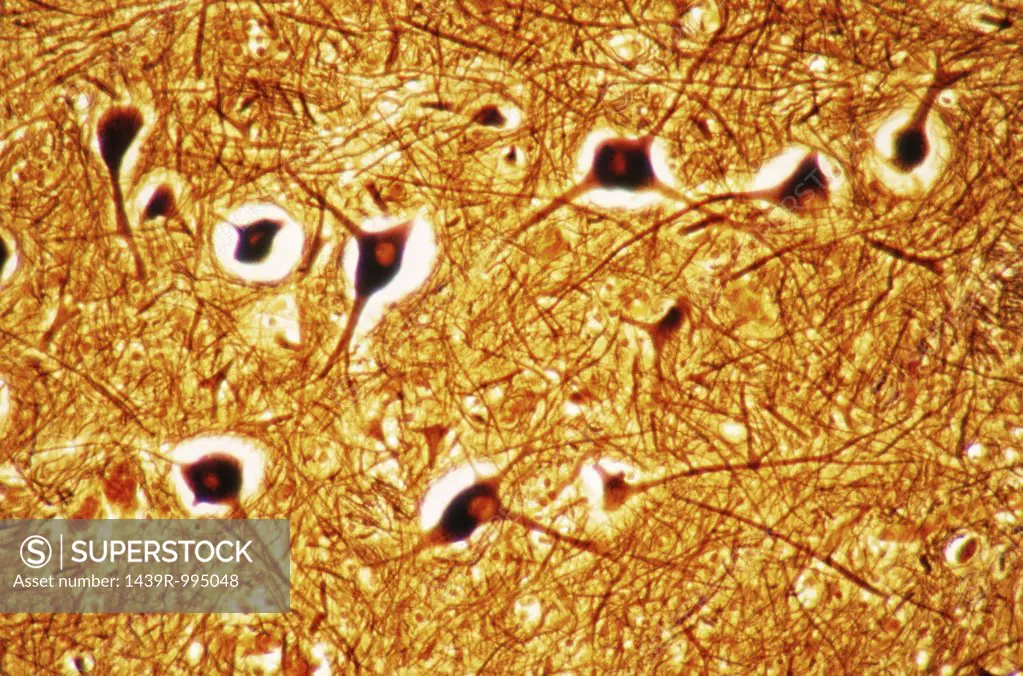 Nerve cells in brain stem
