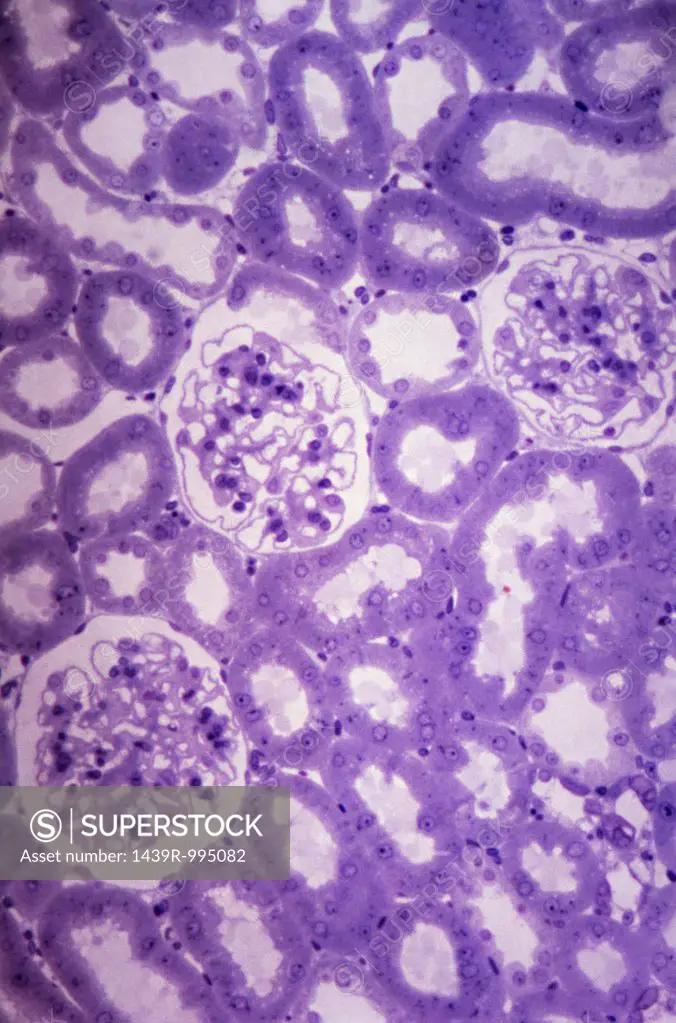 Glomeruli and tubules in kidney