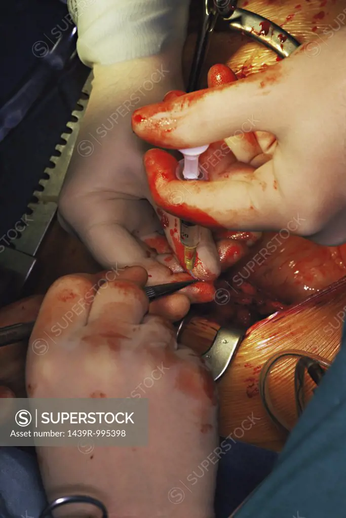 Injection during an operation
