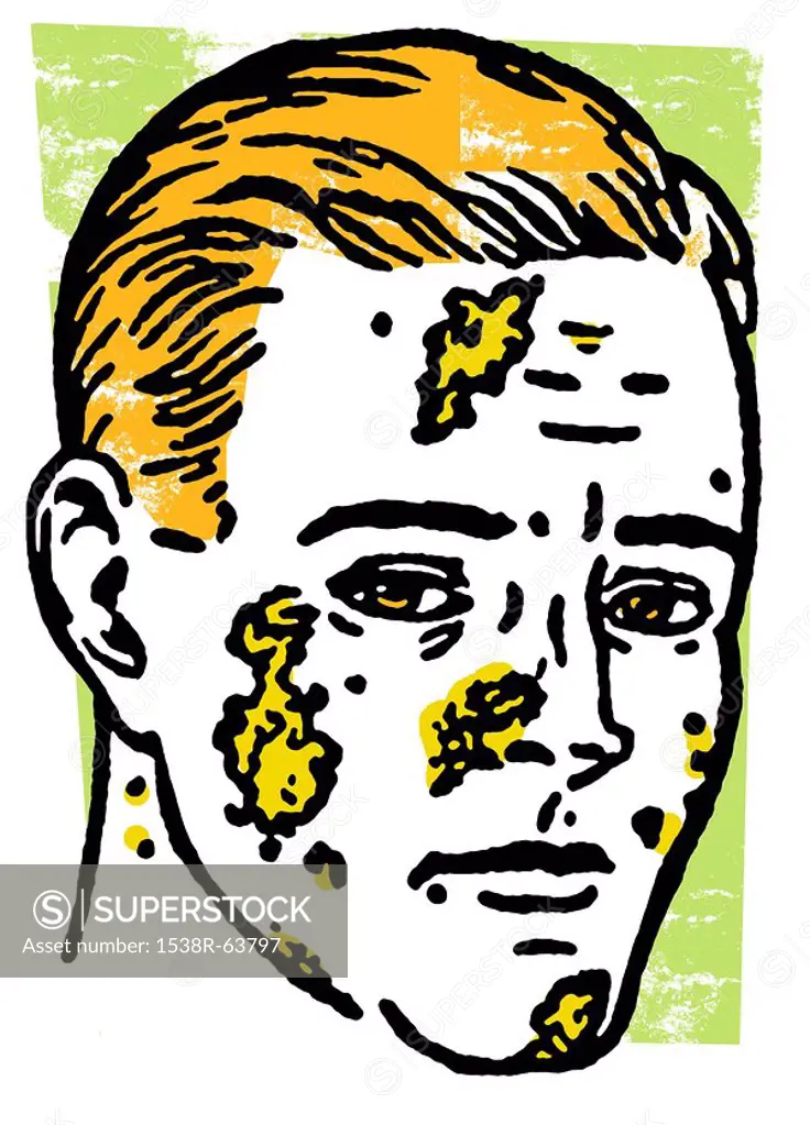 An illustration of an infected man