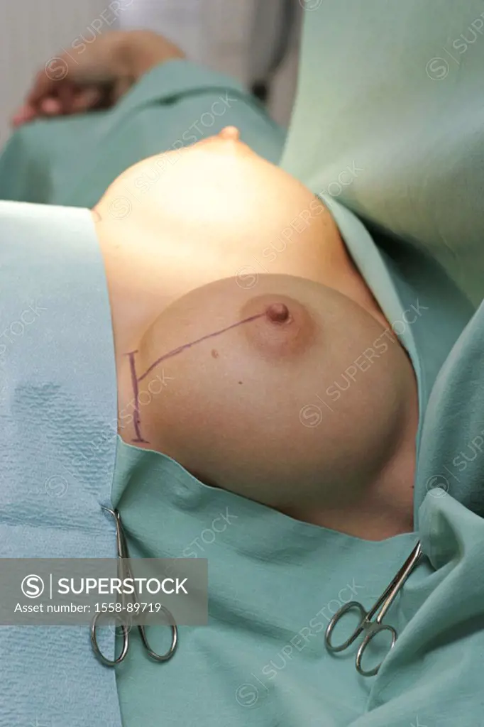 OP-Saal, female patient, breasts, markings,  Breast enlargement,   Series, plastic surgery, woman, bosoms, operation, beauty operation, cosmetic medic...