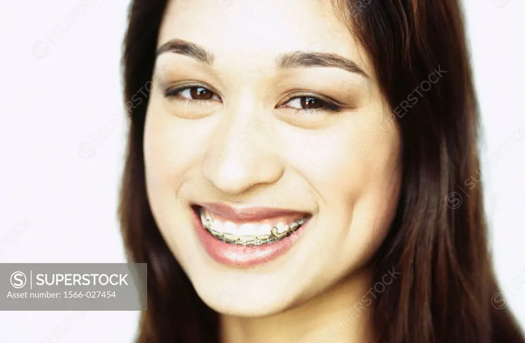 image of young woman with braces, smiling