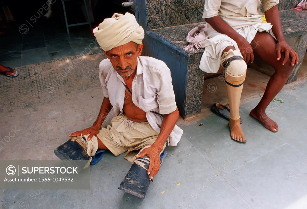 Amputated men. One has a prosthetic leg while another is waiting for two. Jaipur, India.