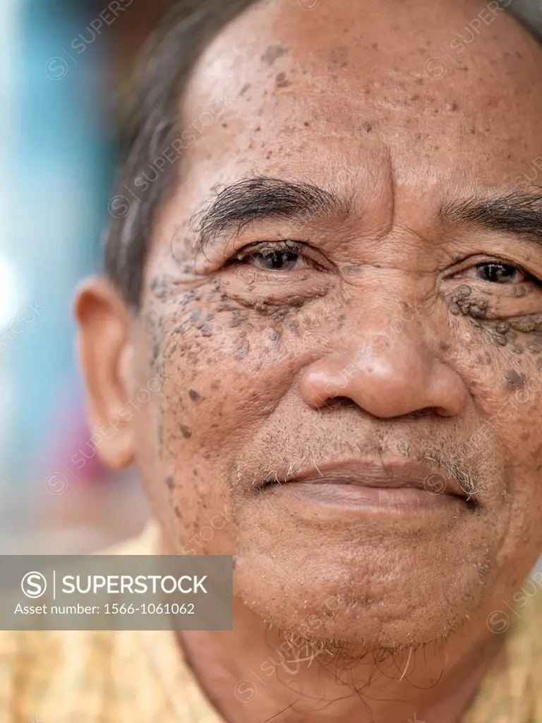 A portrait of an elder man with a lot of facial freckles and birthmarks in Johor, Malaysia