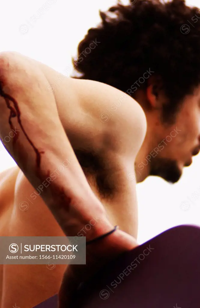 Shirtless male with wound