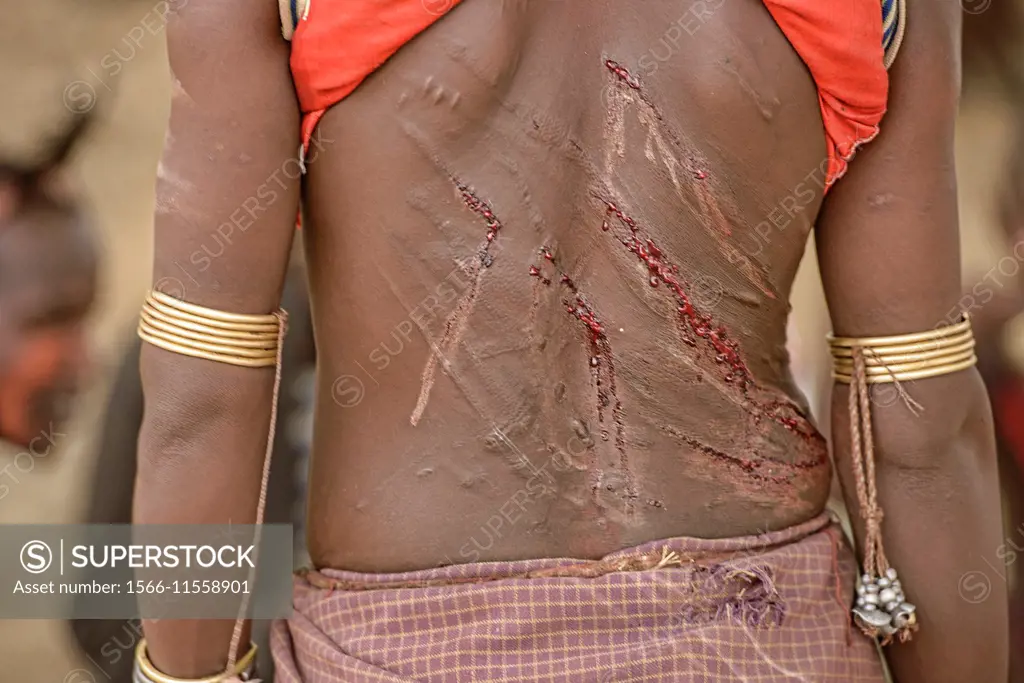Hamer woman´s back after being whipped at a bull jumping ceremony near  Turmi in the Omo Valley, Ethiopia. The young women taunt the men into  hitting t - SuperStock