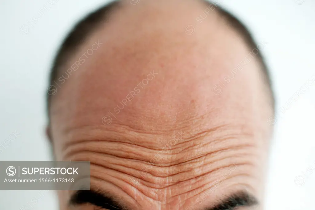 Frente fruncida de hombre calvo de mediana edad, Furrowed brow of middle-aged bald man