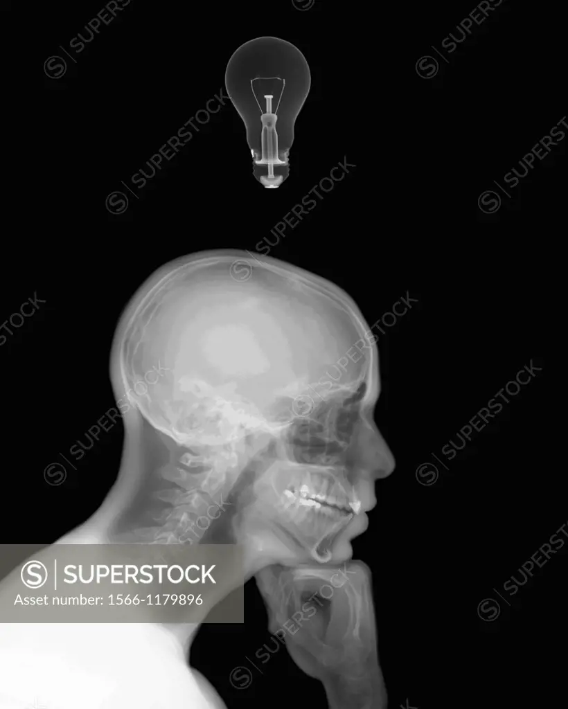 X-ray of a thinking man with a lightbulb