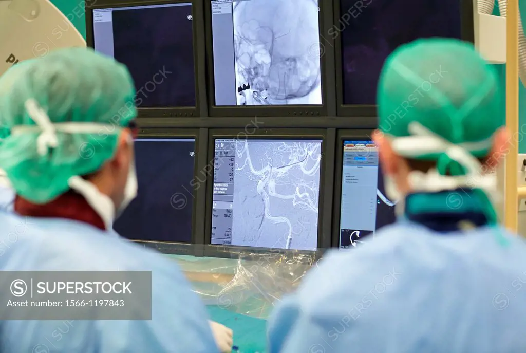 Cerebral aneurysm embolization, Willis polygone angiography, Interventional Neuroradiology, Radiology Department, Donostia Hospital, San Sebastian, Do...