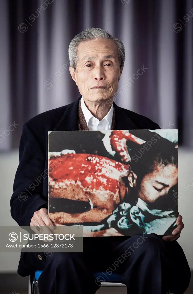 Sumiteru Taniguchi, born in 1929, a Nagasaki Atomic Bomb Survivor, Nagasaki A-bomb sufferers council president, he shows a picture of him 6 months aft...
