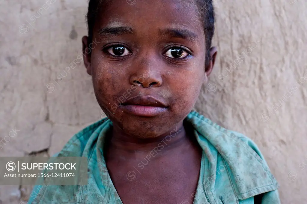Boy from a village in eastern Ethiopia ( Oromiya state).