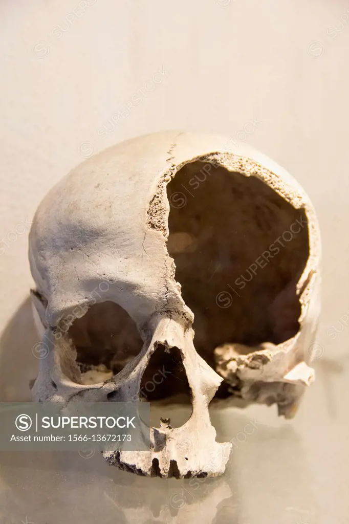 Damaged human skull.
