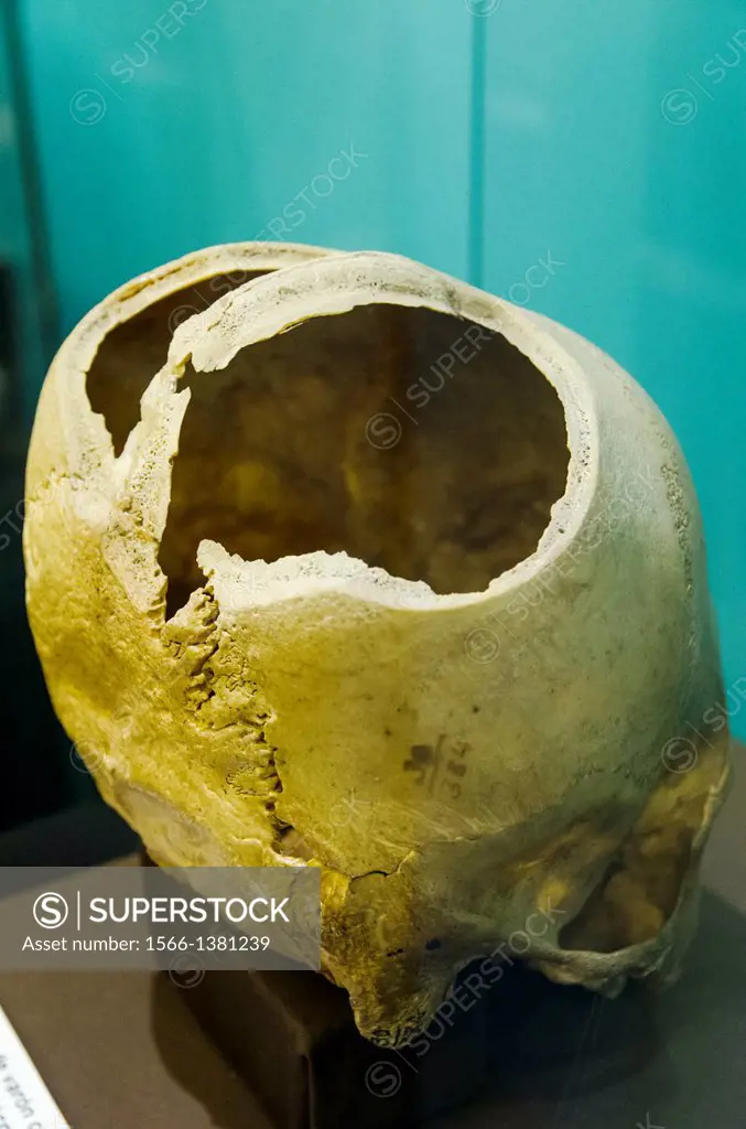 Deformed skulls of Paracas.